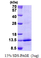 NDUFB4 / B15 Protein