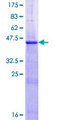 NDUFB5 Protein - 12.5% SDS-PAGE of human NDUFB5 stained with Coomassie Blue