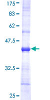 NDUFB5 Protein - 12.5% SDS-PAGE Stained with Coomassie Blue.