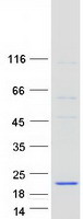 NDUFB6 Protein - Purified recombinant protein NDUFB6 was analyzed by SDS-PAGE gel and Coomassie Blue Staining