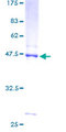 NDUFB8 Protein - 12.5% SDS-PAGE of human NDUFB8 stained with Coomassie Blue