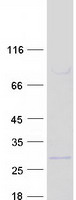 NDUFB9 Protein - Purified recombinant protein NDUFB9 was analyzed by SDS-PAGE gel and Coomassie Blue Staining