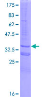 NDUFC2 Protein - 12.5% SDS-PAGE of human NDUFC2 stained with Coomassie Blue