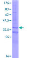 NDUFC2 Protein - 12.5% SDS-PAGE of human NDUFC2 stained with Coomassie Blue