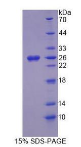 NDUFS1 Protein - Recombinant  NADH Dehydrogenase Ubiquinone Fe-S Protein 1 By SDS-PAGE