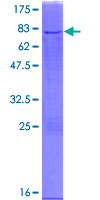 NDUFS2 Protein - 12.5% SDS-PAGE of human NDUFS2 stained with Coomassie Blue