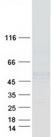 NDUFS2 Protein - Purified recombinant protein NDUFS2 was analyzed by SDS-PAGE gel and Coomassie Blue Staining