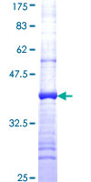 NDUFS3 Protein - 12.5% SDS-PAGE Stained with Coomassie Blue.