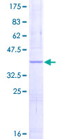 NDUFS5 Protein - 12.5% SDS-PAGE of human NDUFS5 stained with Coomassie Blue