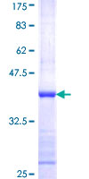 NDUFS5 Protein - 12.5% SDS-PAGE Stained with Coomassie Blue.