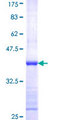 NDUFS5 Protein - 12.5% SDS-PAGE Stained with Coomassie Blue.