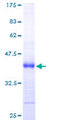NDUFS6 Protein - 12.5% SDS-PAGE of human NDUFS6 stained with Coomassie Blue
