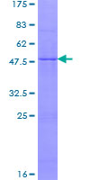 NDUFS7 Protein - 12.5% SDS-PAGE of human NDUFS7 stained with Coomassie Blue