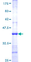 NDUFS7 Protein - 12.5% SDS-PAGE Stained with Coomassie Blue.
