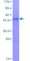 NDUFS8 Protein - 12.5% SDS-PAGE of human NDUFS8 stained with Coomassie Blue