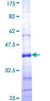 NDUFS8 Protein - 12.5% SDS-PAGE Stained with Coomassie Blue.