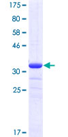 NDUFV1 Protein - 12.5% SDS-PAGE Stained with Coomassie Blue.