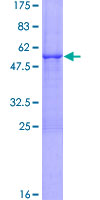 NDUFV2 Protein - 12.5% SDS-PAGE of human NDUFV2 stained with Coomassie Blue