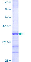 NDUFV2 Protein - 12.5% SDS-PAGE Stained with Coomassie Blue.