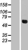 NDUFV3 Protein - Western validation with an anti-DDK antibody * L: Control HEK293 lysate R: Over-expression lysate