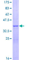 NDUFV3 Protein - 12.5% SDS-PAGE of human NDUFV3 stained with Coomassie Blue
