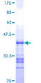 NDUFV3 Protein - 12.5% SDS-PAGE Stained with Coomassie Blue.