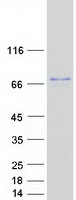 NDUFV3 Protein - Purified recombinant protein NDUFV3 was analyzed by SDS-PAGE gel and Coomassie Blue Staining