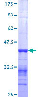 NEB / Nebulin Protein - 12.5% SDS-PAGE Stained with Coomassie Blue.