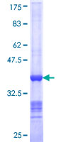 NEDD1 Protein - 12.5% SDS-PAGE Stained with Coomassie Blue.