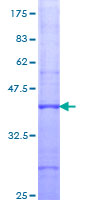 NEDD4 Protein - 12.5% SDS-PAGE Stained with Coomassie Blue.