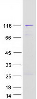 NEDD4 Protein - Purified recombinant protein NEDD4 was analyzed by SDS-PAGE gel and Coomassie Blue Staining