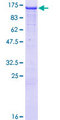 NEDD4L / NEDD4-2 Protein - 12.5% SDS-PAGE of human NEDD4L stained with Coomassie Blue