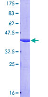 NEDD4L / NEDD4-2 Protein - 12.5% SDS-PAGE Stained with Coomassie Blue.