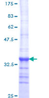 NEDD8 Protein - 12.5% SDS-PAGE Stained with Coomassie Blue.