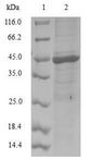 NEDD8 Protein - (Tris-Glycine gel) Discontinuous SDS-PAGE (reduced) with 5% enrichment gel and 15% separation gel.