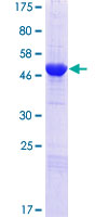 NEDF / VPS24 Protein - 12.5% SDS-PAGE of human VPS24 stained with Coomassie Blue