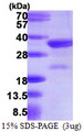NEDF / VPS24 Protein
