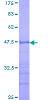 NEDL2 / HECW2 Protein - 12.5% SDS-PAGE Stained with Coomassie Blue.
