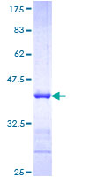 NEFH / NF-H Protein - 12.5% SDS-PAGE Stained with Coomassie Blue.