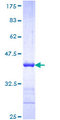 NEFH / NF-H Protein - 12.5% SDS-PAGE Stained with Coomassie Blue.