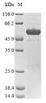 NEFM / NF-M Protein - (Tris-Glycine gel) Discontinuous SDS-PAGE (reduced) with 5% enrichment gel and 15% separation gel.