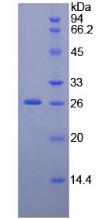 NEFM / NF-M Protein - Recombinant Neurofilament 3 By SDS-PAGE