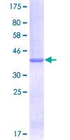 NEGR1 / Neurotractin Protein - 12.5% SDS-PAGE Stained with Coomassie Blue.