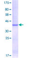 NEGR1 / Neurotractin Protein - 12.5% SDS-PAGE Stained with Coomassie Blue.