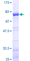 NEIL1 Protein - 12.5% SDS-PAGE of human NEIL1 stained with Coomassie Blue