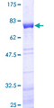 NEIL1 Protein - 12.5% SDS-PAGE of human NEIL1 stained with Coomassie Blue