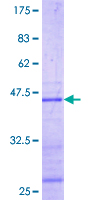 NEIL1 Protein - 12.5% SDS-PAGE Stained with Coomassie Blue.