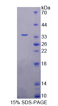 NEIL1 Protein - Recombinant  Nei Endonuclease VIII Like Protein 1 By SDS-PAGE
