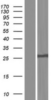 NEIL2 Protein - Western validation with an anti-DDK antibody * L: Control HEK293 lysate R: Over-expression lysate