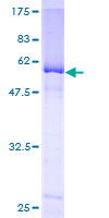 NEIL2 Protein - 12.5% SDS-PAGE of human NEIL2 stained with Coomassie Blue